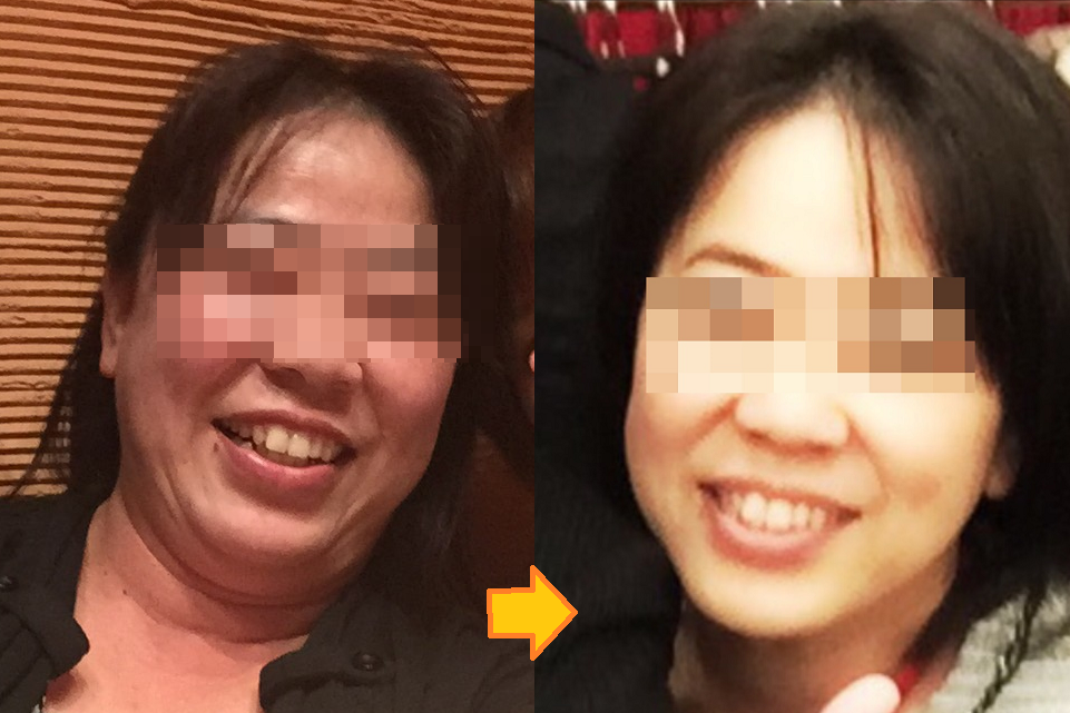 Ｎさまの体験写真